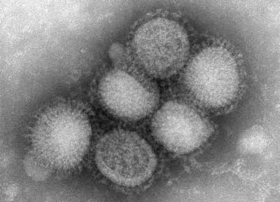 En molekylær David? Svineinfluenza er en virus med en diameter på kun 80-120 nanometer, men den kan alligevel bringe de fleste mennesker om kuld. Forstørrelsen på billedet her er ca. 100.000 gange.